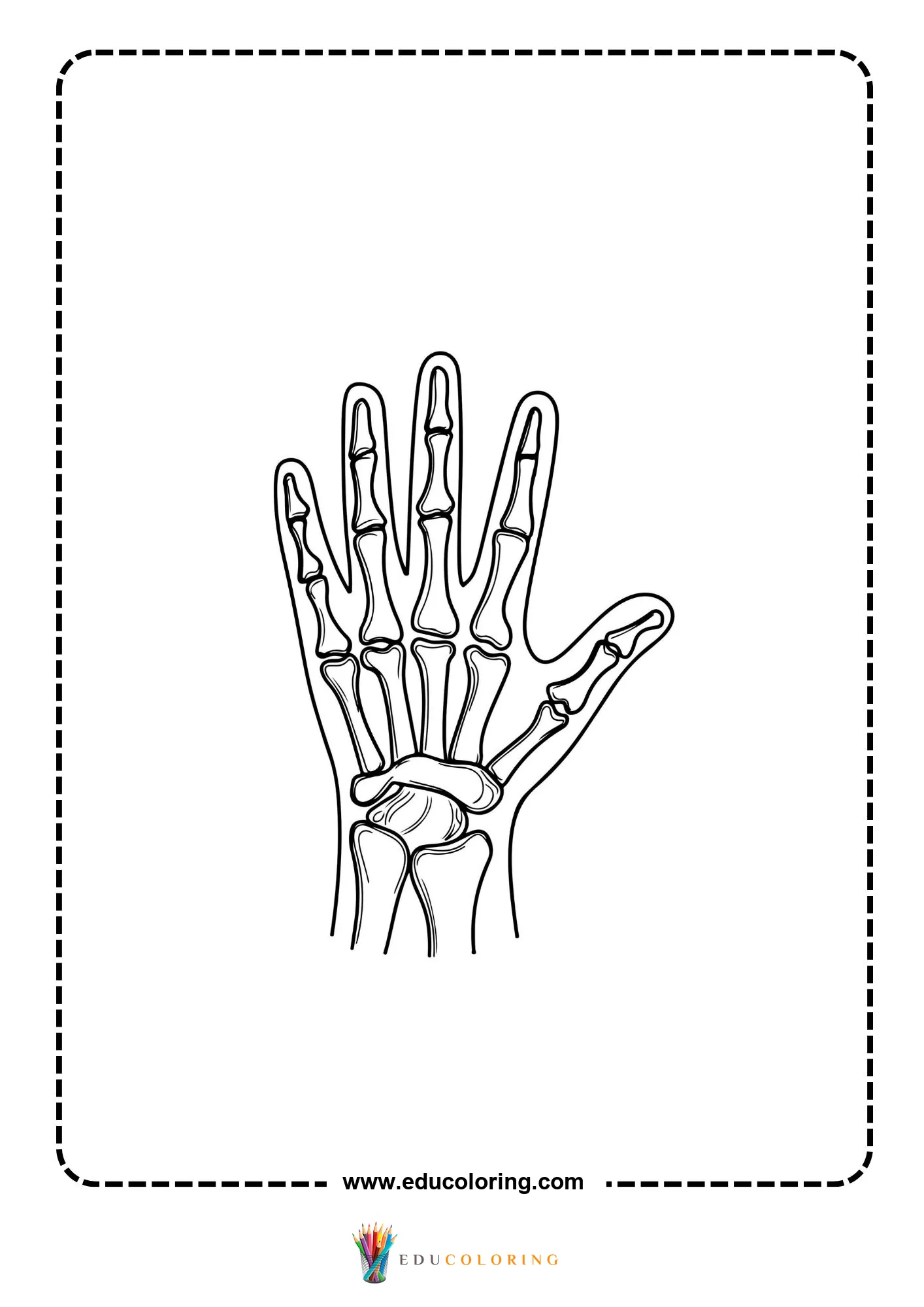 Hand bone x ray